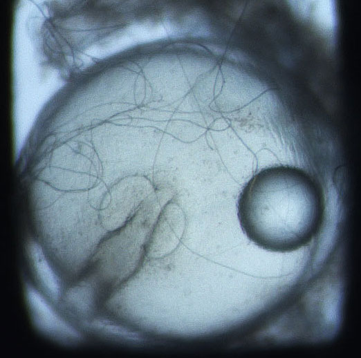 16May-NCB1-23h-25C-Menidia-embryo01
